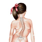 Early onset Scoliosis