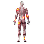 Musculoskeletal Injuries