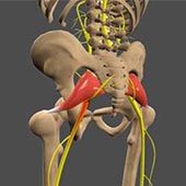 Sciatica