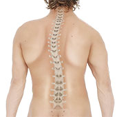 Scoliosis in Children