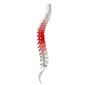 Spine Trauma